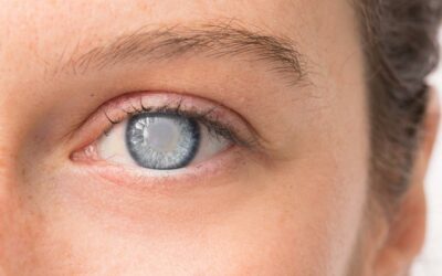 Recognizing the Signs of Macular Degeneration