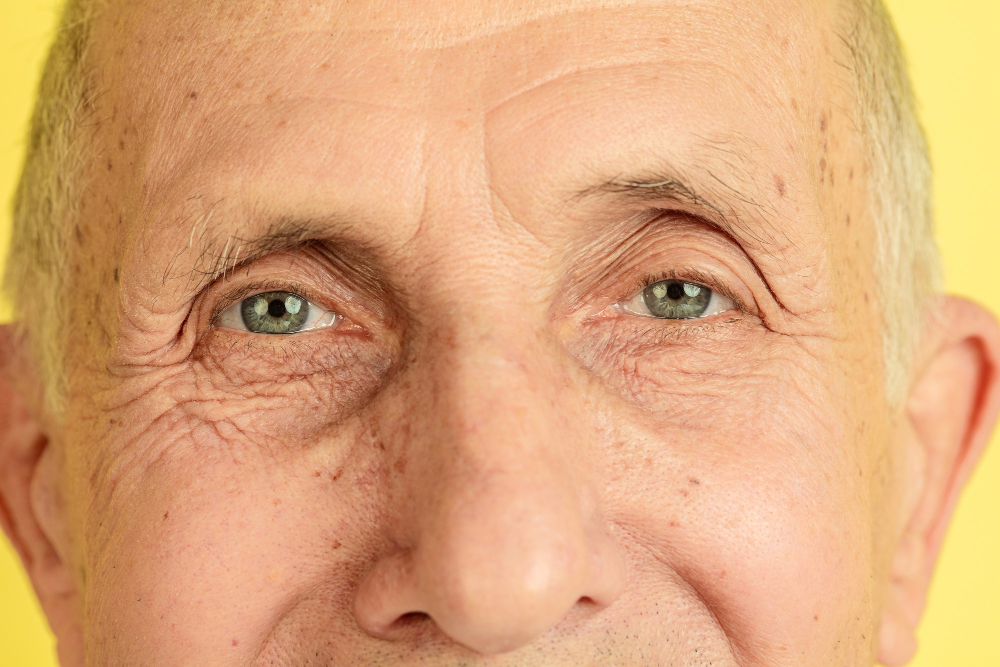 Understanding Age-Related Macular Degeneration: Causes, Symptoms, and Treatment Options