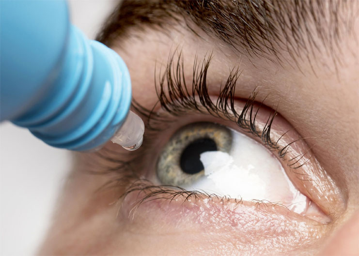 Dry Eye Relief Tips: Expert Advice for Soothing Your Eyes